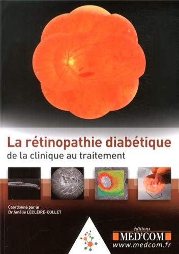 La  rétinopathie diabétique