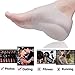 Plantar Fasciitis Height Increase Heels Sleeves, 1 Pair Gel Heel Height Invisible Elevators, Pads, Arch Support, Heel Protectors, Foot Cushion, W6-9 |M6.5-8(White)