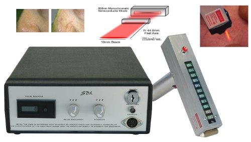 SDL-80aDX Laser Hair Removal Machine for bikini line, face and body, treatment of vascular lesions and spider veins.