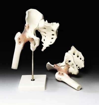 Hip Joint Model with Detachable Ligaments