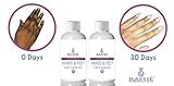 Pre-neutralized: 2 Bottles Of Hands N Feet Gell Corrector For Hydroquinone Damaged Digits. A 7 DAY Bleaching Peel For Hands & Feet Previously Damaged By Hydroquinone Products 30ml each/ 60ml Both
