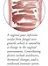 Yeast Infection Treatment Pill | #1 Gynecologist Recommended - Two Ingredients Needed for a Woman's Body - Get to The Core of Infections - Natural Health Bonus Ebook
