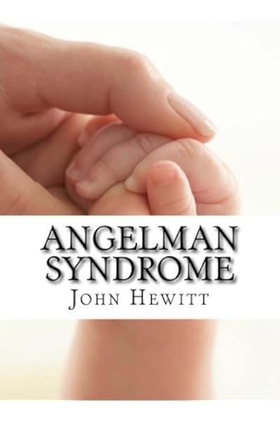 49+ Angelman Syndrome Baby Signs Pics