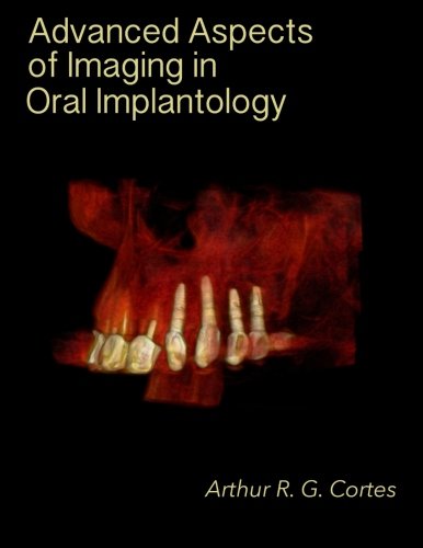 Advanced aspects of imaging in oral implantology