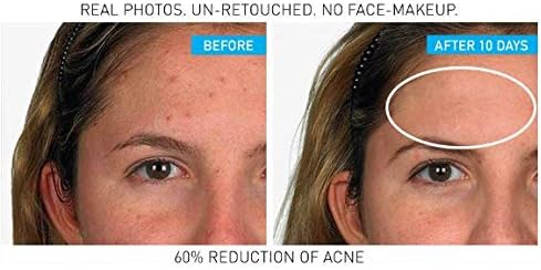 effaclar duo initial breakout