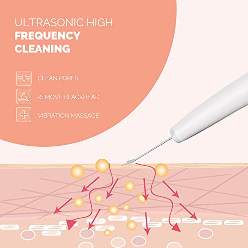 Electric Facial Skin Scrubber Blackhead Remover - Rechargeable Face Spatula Cleansing Brush [2019 NEW] - Thumbnail 4