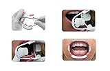 Airgoesin Oral Intraoral Cheek Lip Retractor Opener Mouth Prop Tooth Whitening 3D Adult Dental Tool