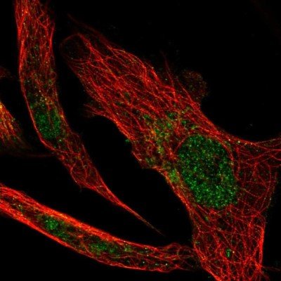 Glutathione Peroxidase 4 Gpx4 Antibody
