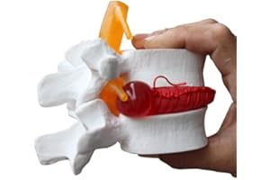 BoNew-Oral 1:1.5 Anatomical Human Lumbar Vertebrae Degenerative Lumbar Human Spine Model White Color