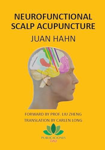 YNSA: Yamamoto New Scalp Acupuncture - Kindle edition by Hahn