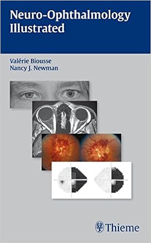 Neuro Ophthalmology Illustrated 9781604061567 Medicine - 