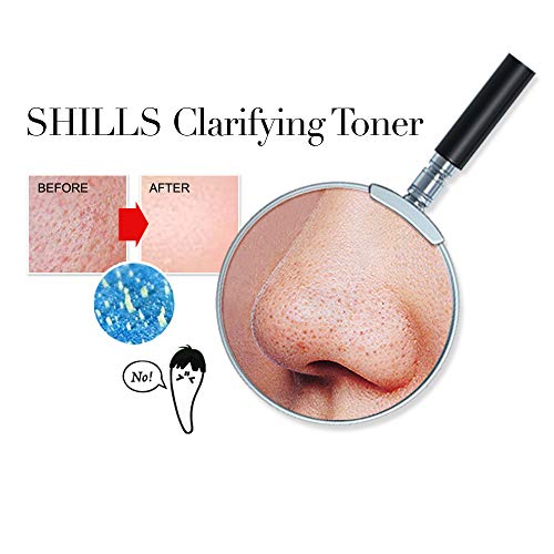 SHILLS Blackhead Remover 3 Step Kit, Black Mask Peel Off, Purifying Charcoal Sebum Softener, Pore Minimizing Toner, Peel Strip Mask, Acne Black Mud Facial Masks (Kit) - Thumbnail 7
