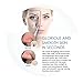 Blackhead Remover Vacuum Pimple Extractor – Best Microdermabrasion Removal Tool Machine – Professional Electric Comedone Popper Remove Blackheads – Fast Remove Dark Spot Beauty Device for Woman Men