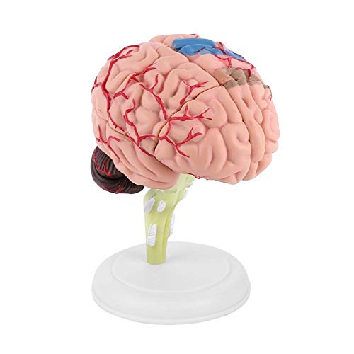 Brain Model - Anatomical Medical Model Disassembled Anatomical Human Brain Model Medical Teaching Tool Toy - Thumbnail 5