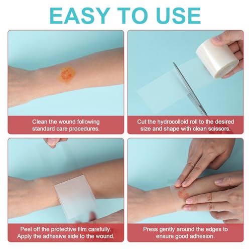 Hydrocolloid Plaster Roll 5 cm x 3.6 m, Self-Adhesive Hydrocolloid Wound Plasters for Blisters, Cuts & Skin Protection, Various Sizes, Can Be Cut to Size, Pack of 1