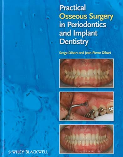 ITI Treatment Guide: Implant Therapy in the Esthetic Zone for