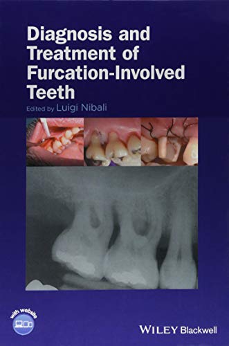 [B.O.O.K] Diagnosis and Treatment of Furcation-Involved Teeth<br />[K.I.N.D.L.E]