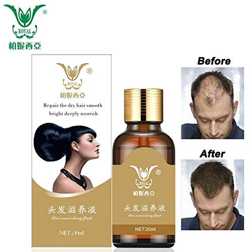 Buy Royal Beauty Fast Hair Growth Faster Hair Regrowth Men Women