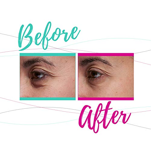 Tria-Beauty-Age-Defying-Eye-Wrinkle-Correcting-Laser-FDA-cleared-younger-looking-skin-in-as-little-as-2-weeks