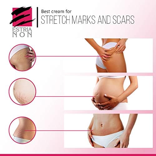 best stretch mark removal cream for men