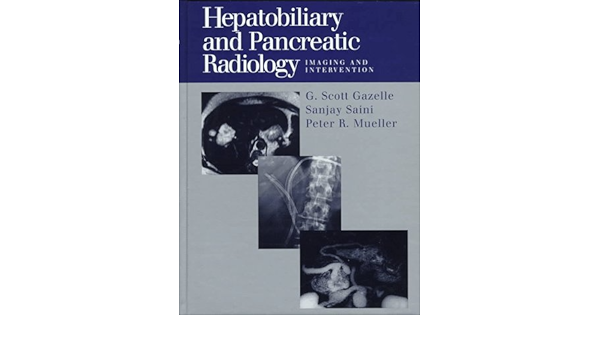 Hepatobiliary And Pancreatic Radiology Imaging And Intervention Gazelle G Scott Saini Sanjay Mueller Peter R 9780865777163 Amazon Com Books Hepatobiliary And Pancreatic Radiology Imaging And Intervention Gazelle G Scott Saini Sanjay Mueller Peter R 9780865777163 Amazon Com Books