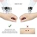 Zdatt Blackhead Remover Pore Vacuum with Beauty Lamp Care Comedo Suction Exfoliating Electric Comedone Acne Extractor Facial Cleaner with 5 Suction Heads and 5 Level Suction Force-FDA Approved