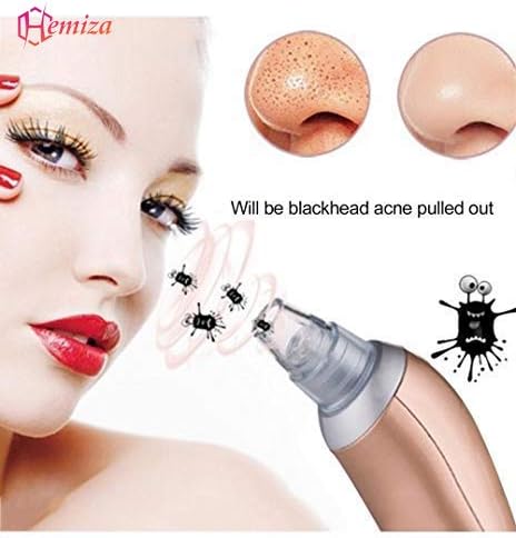 HEMIZA ZT Men's and Women's 4 in 1 Multi-Function Rechargeable Blackhead Whitehead Remover Vacuum Suction Device for Facial Care with Adapter (Colour Assorted)