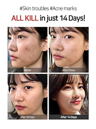 some by mi all kill cream