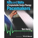 The Nuts And Bolts Of Icd Therapy Kenny Tom 9781405135115 Amazon Com Books