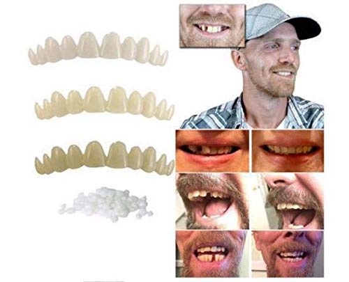 QWE Snap On Smile Instant Teeth Whitening Cosmetics Teeth, Dental Dentures Care for A New Single-Plate Tooth of Comfortable Size