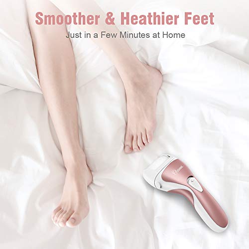 Ovonni Electric Callus Remover, Professional Powerful Rechargeable Foot File for Feet, Portable Cordless Waterproof Callus Shaver with 3 Roller Heads for Dead Hard & Cracked Dry Skin (Gold) - Thumbnail 7