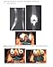 Total Knee Arthroplasty