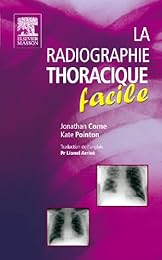 Radiographie thoracique facile