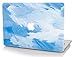 KECC Compatible with MacBook Pro 13 inch Case 2020-2025, 2016-2019 Release M2 M1 A2338 A2289 A2251 A2159 A1989 A1706 A1708 Plastic Hard Shell Case, Blue - Water Paint