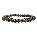 Adult Baltic Amber Bracelet (Unisex, Green, 7.5 Inches) Lab-Tested, 100% Certified Baltic Amber - All Natural Pain Relief & Anti-Inflammatory For Migraine, Sinus, Arthritis & More