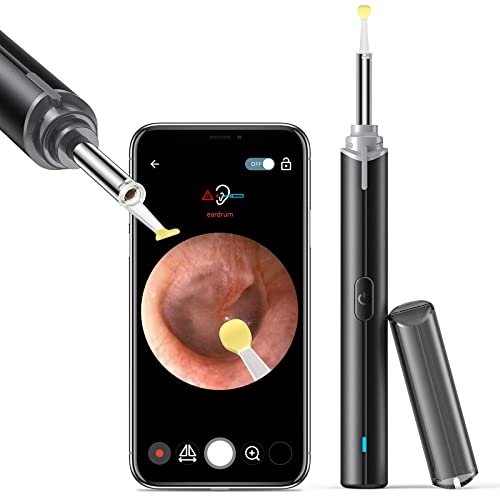 HD Camera Earwax Removal Kit, Ear Wax Removal Cleaning Kit With 1080P HD Camera And 6 LED Lights, Wireless Ear Wax Removal Tool With 8 Ear Pick For IPhone And Android - View #9