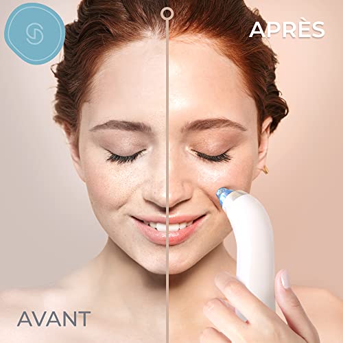 Essy Blackhead Vacuum Cleaner Blackhead Remover Blackhead Remover Face Machine Machine Vacuum Blackhead Nose Skin Purifier Blackhead Extractor Blackhead Extractor Comedon Vacuum Cleaner Button Face Remove Button