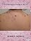 Livro Tratamento contra a acne