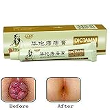 Chinese Herbal For Treatment Hemorrhoids Cream Anus Prolapse Anal Fissure Antibacterial Cream By Shouhengda (1 Pcs Pack)