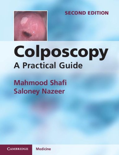 COLPOSCOPY