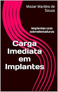 Livro Carga Imediata em Implantes: Implantes com sobredentaduras