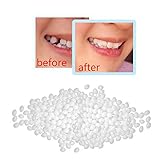 Startview Temporary Tooth Repair Kit Teeth and Gaps FalseTeeth Solid Glue Denture Adhesive White