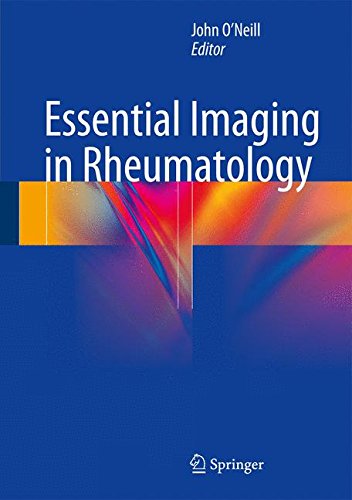 [EBOOK] Essential Imaging in Rheumatology W.O.R.D