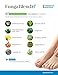 FungaBlend 10 Tolnaftate Antifungal Solutionthumb 1