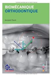 Biomécanique orthodontique