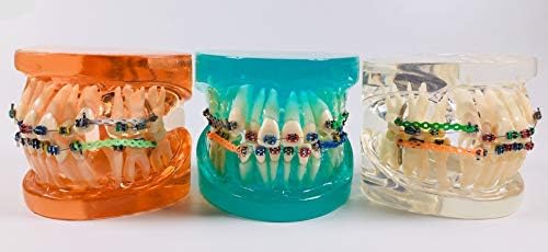 3 Colors Dental Orthodontic Brace Model Malocclusion Wrong Jaw Brackets +Ligature Tie +Implant AnchorDrill + Chains+Buccal Tubes (Clear1 piece)