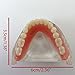 Smile1000 Dental Model Overdenture Inferior 2 Implants Demo for Studing and Teaching