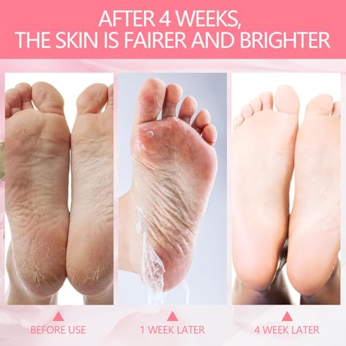 2 Pairs Exfoliating Peeling Foot Mask, Soft Exfoliating Action, Heels and Dry Dead Skin for Soft Feet, Long Moisturizing, Moisturizing Foot Mask (Pink/Aloe)