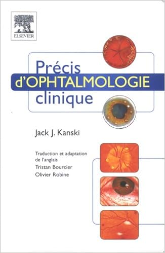 Precis D Ophtalmologie Clinique Pdf Telecharger Onodlesresetfern