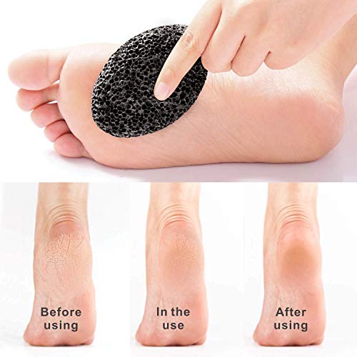 Natural Pumice Stone for Feet(Pack of 2), Chialstar Lava Pedicure Tools Hard Skin Callus Remover for Feet and Hands - Natural Foot File Exfoliation to Remove Dead Skin - Includes Bag and Suction Hook
